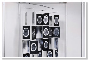HuM-ART - "In-Between-Soul" (Detail), Kinetisches Objekt, 2011-13